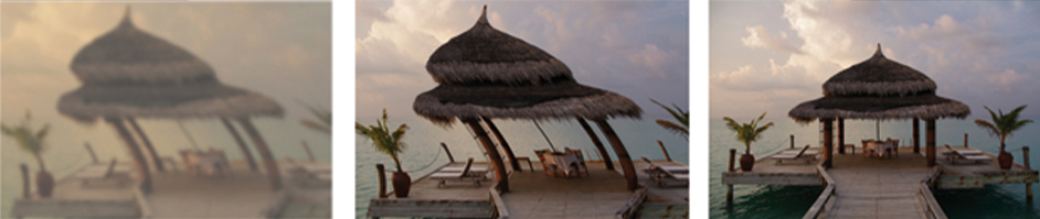 Standardlinsen – Augenärztliche Gemeinschaftspraxis | Dr. Heuring, Dr. Jung & Kollegen