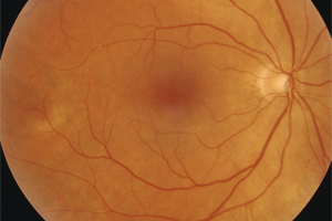 Fotodokumentation – Augenärztliche Gemeinschaftspraxis | Dr. Heuring, Dr. Jung & Kollegen