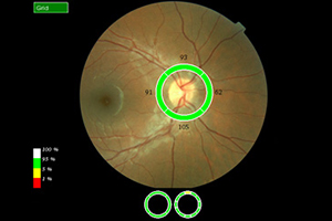 Nervenfaseranalyse – Augenärztliche Gemeinschaftspraxis | Dr. Heuring, Dr. Jung & Kollegen