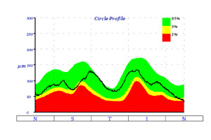 Nervenfaseranalyse – Augenärztliche Gemeinschaftspraxis | Dr. Heuring, Dr. Jung & Kollegen
