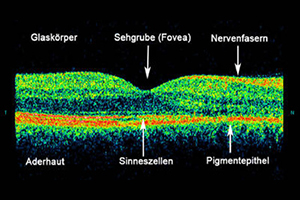 Optische Kohärenztomographie – Augenärztliche Gemeinschaftspraxis | Dr. Heuring, Dr. Jung & Kollegen